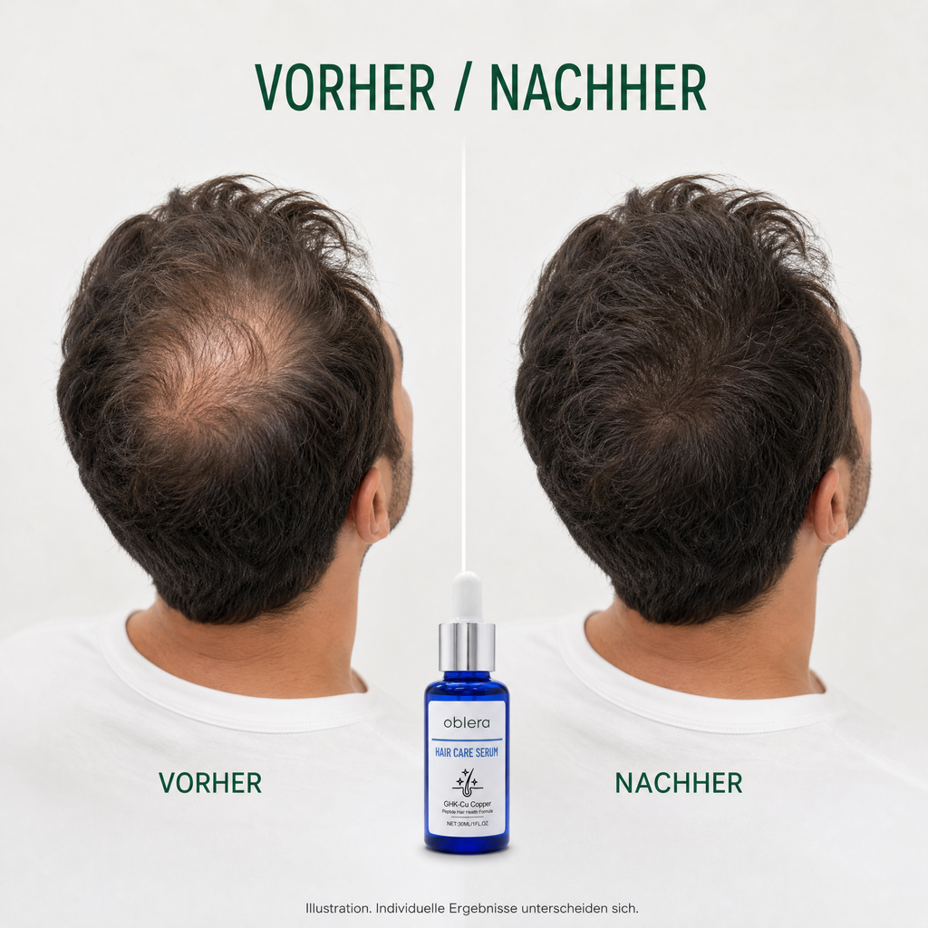 Illustration Vorher/Nachher am Oberkopf, individuelle Ergebnisse unterscheiden sich